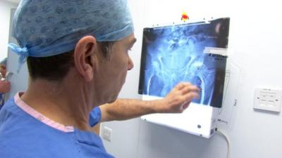 Dr James Wootton looks at hip X-ray