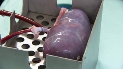 A kidney attached to a perfusion machine