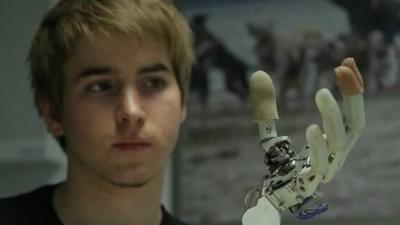 Bionic hand