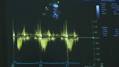 An echocardiogram