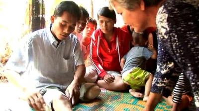 A landmine victim in Cambodia