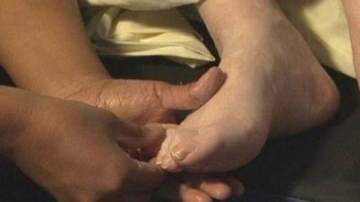 A carer massages the feet of a woman with advanced dementia