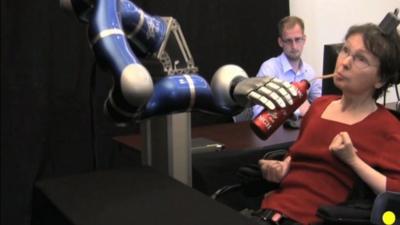 Robotic arm controlled by patient's brain