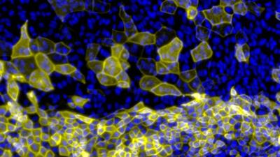 New yellow skin cells emerging from stem cells