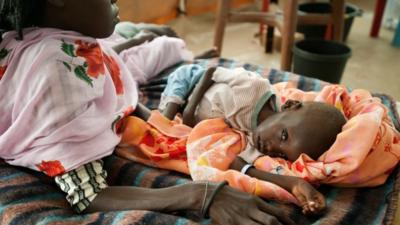 A malnourished child in a refugee camp, South Sudan 20 June 2012