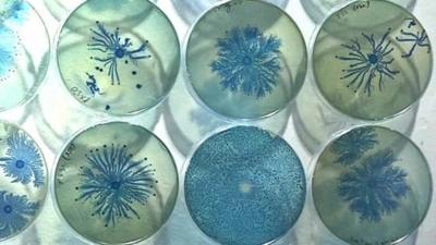 Bacteria growth patterns on display