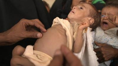 A baby being held by it's mother