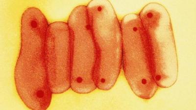 Tuberculosis virus bacteria