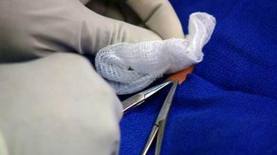 A doctor demonstrates how a circumcision is done on a doll