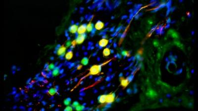 Nerve cells created from human embryonic stem cells in gerbils