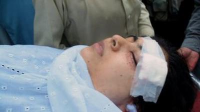 Malala was shot in the head on her way to school