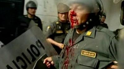 Injured police officer in Peru