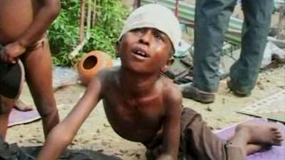 A wounded Sri Lankan child