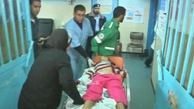 Injured girl on a stretcher in Gaza