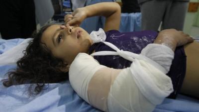 Injured girl with bandaged arm on hospital bed