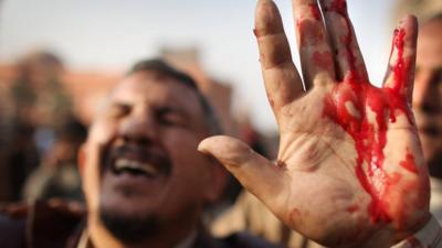 Tahrir Square protest clashes