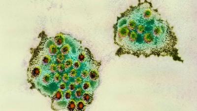 norovirus