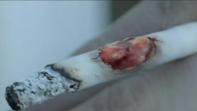 Cigarette with tumour