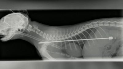 X-ray image