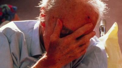 elderly man covering his face