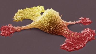 Cancer cell