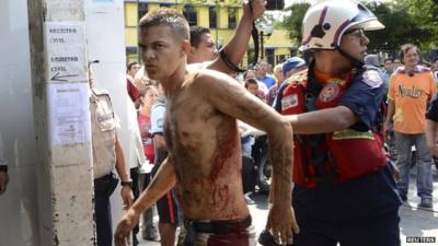 A rescue worker walks with an unidentified injured man during an uprising at the Centro Occidental prison in Barquisimeto, Venezuela