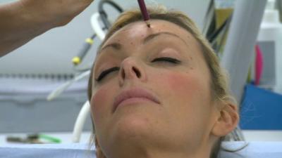 Woman being prepared for botox injection