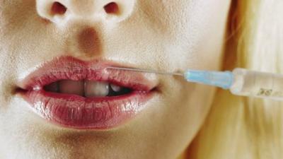 lip fillers injection