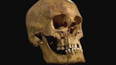 University of Leicester photo of the skull found at Grey Friars