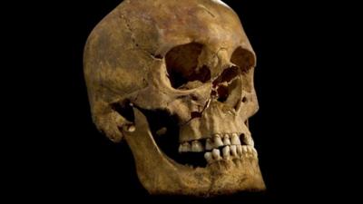 Skull of the skeleton found at the Grey Friars excavation in Leicester