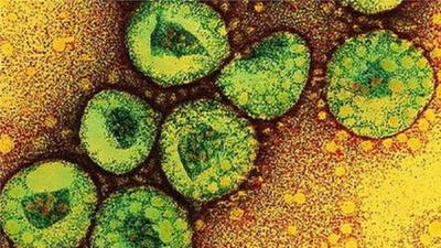 Coronavirus