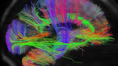 Side view of the wiring map of Pallab Ghosh's brain