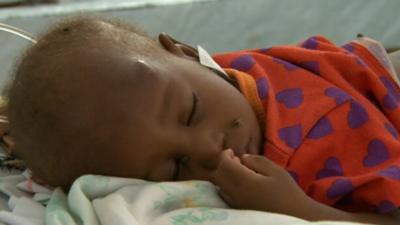 A child suffering from cholera