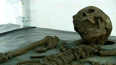 The top half of a skeleton lying on a table