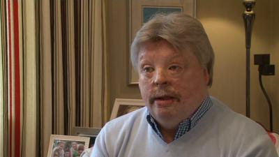 Simon Weston