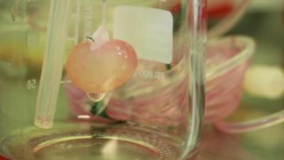 The rat kidney in a glass jar