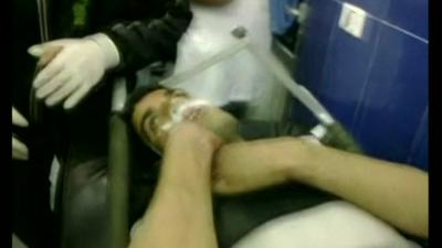 Patient on a hospital bed suffering from suspected chemical weapon attack