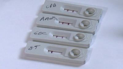 Four leprosy tests alongside eachother