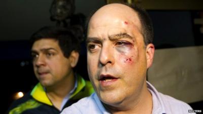 Venezuelan opposition lawmaker Julio Borges of the Primero Justicia party arrives at a news conference with a bruised and bloodied face