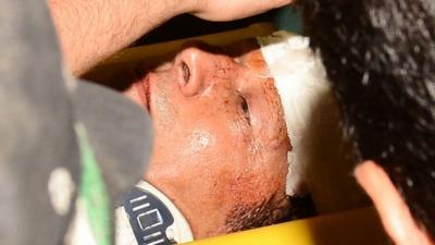 Imran Khan being stretchered off after his fall