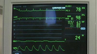 Heart monitor