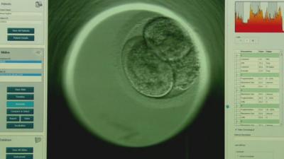 Time lapse images of human embryo