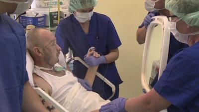 Transplant patient shown new face