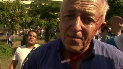 The BBC's Jeremy Bowen was hit by shot gun pellets above the ear