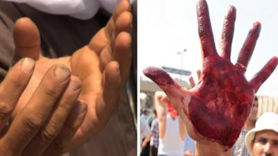 Praying hands next to bloodied hand in Egypt