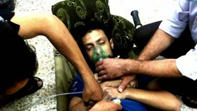 Man with oxygen mask on after alleged chemical attack in Damascus