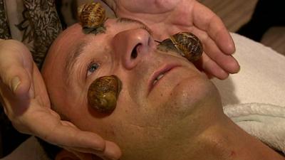 A man has three snails placed on his face