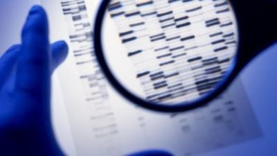 DNA autoradiogram