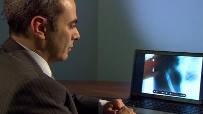 Doctor looking at x-ray on computer screen