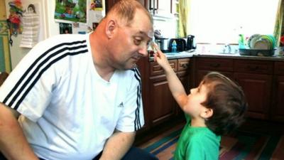 Ian Tibbetts after his eye operation